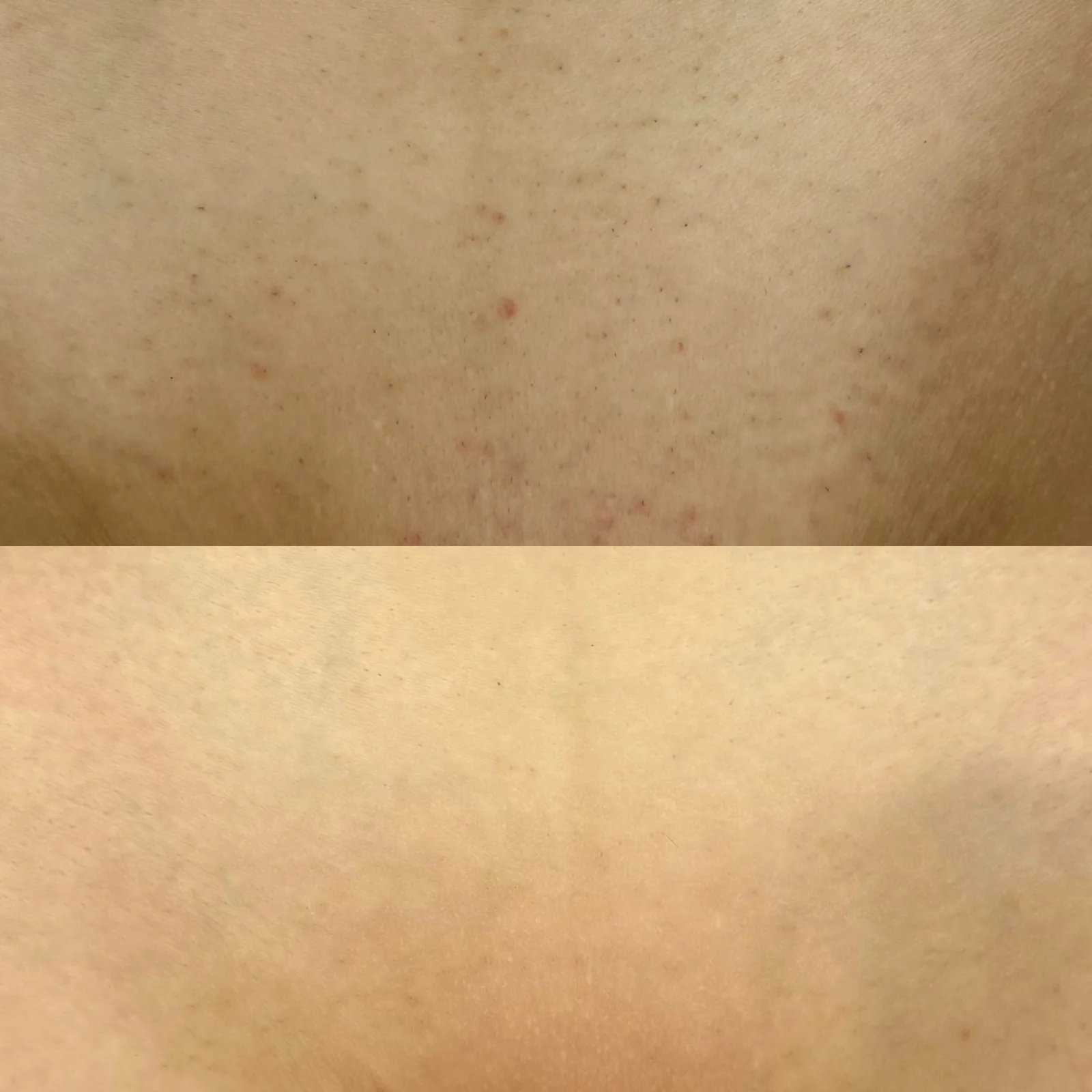 Before and after result 3 visits