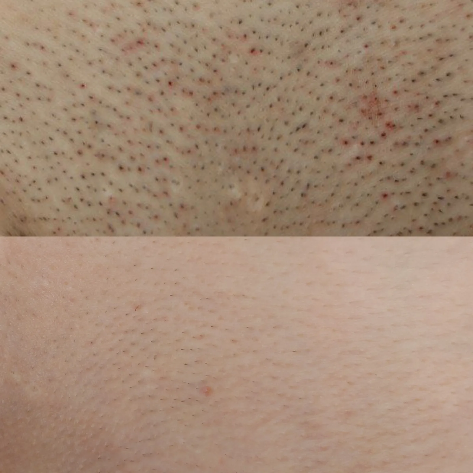 Before and after result 3 visits