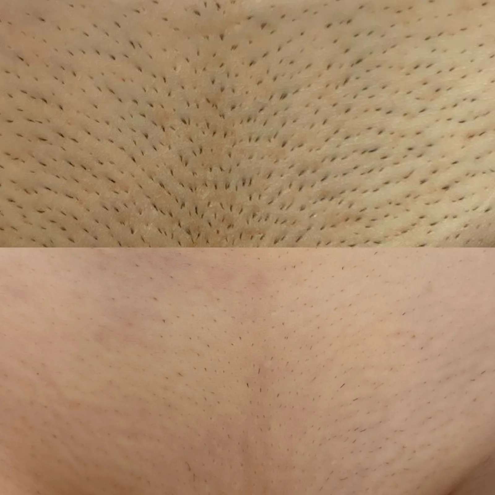 Before and after result 6 visits